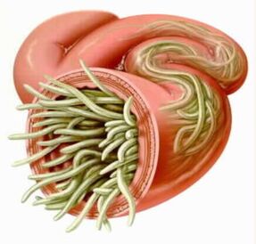 Parasites in the intestines