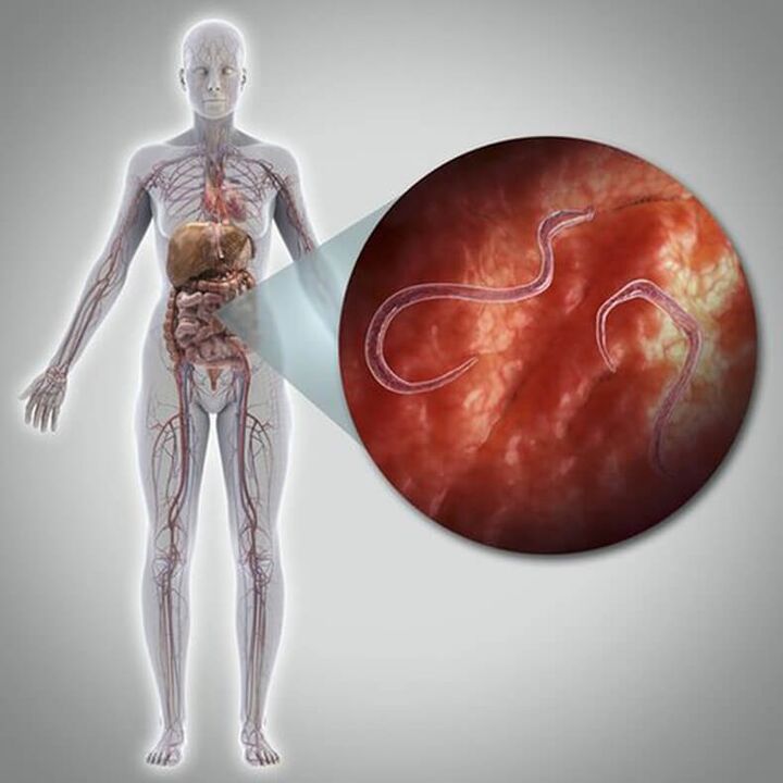 Parasites in the body of a person